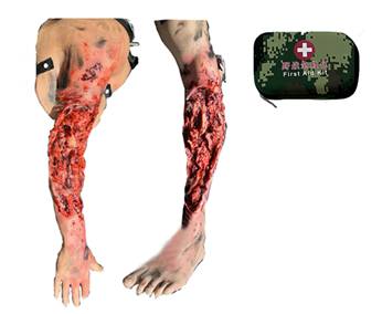 ����ʽ��ѪֹѪģ�MӖ(x��n)����(��֫����֫��